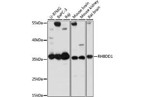 Western blot analysis of extracts of various cell lines, using RHBDD1 antibody (ABIN7269978) at 1:1000 dilution. (RHBDD1 抗体  (AA 206-315))