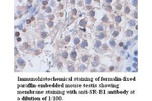 Image no. 1 for anti-Scavenger Receptor Class B, Member 1 (SCARB1) antibody (ABIN791178) (SCARB1 抗体)
