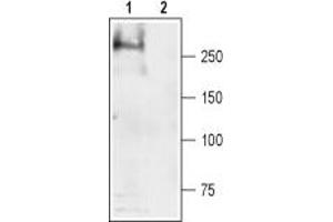 Western blot analysis of rat skeletal muscle lysate: - 1. (SCN4A 抗体  (Intracellular))