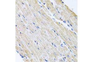Immunohistochemistry of paraffin-embedded mouse heart using ABCB8 antibody at dilution of 1:100 (x40 lens). (ABCB8 抗体)
