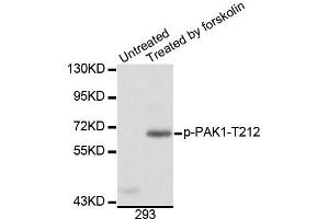 Western blot analysis of extracts of 293 cells, using Phospho-PAK1-T212 antibody (ABIN5996121). (PAK1 抗体  (pThr212))