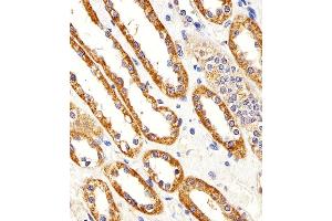 Immunohistochemical analysis of paraffin-embedded H. (Cystin 1 抗体  (C-Term))