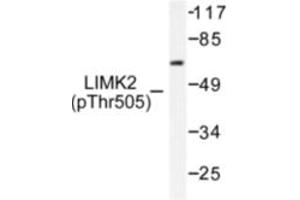 Image no. 1 for anti-LIM Domain Kinase 2 (LIMK2) (pThr505) antibody (ABIN318064) (LIMK2 抗体  (pThr505))