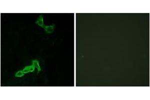 Immunofluorescence analysis of MCF7 cells, using GPR137C Antibody. (GPR137C 抗体  (AA 256-305))