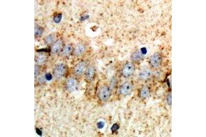 Immunohistochemical analysis of ABCB8 staining in rat brain formalin fixed paraffin embedded tissue section. (ABCB8 抗体)