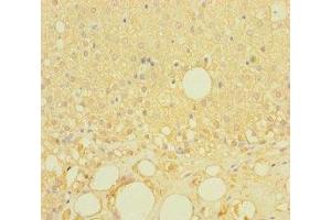 Immunohistochemistry of paraffin-embedded human adrenal gland tissue using ABIN7158146 at dilution of 1:100 (LRRC19 抗体  (AA 25-270))