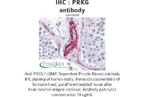 Image no. 3 for anti-PRKG antibody (ABIN1738352) (PRKG 抗体)
