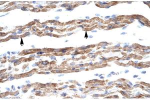 Human Muscle; HumanMuscle; PQBP1 antibody - middle region in Human Muscle cells using Immunohistochemistry (PQBP1 抗体  (Middle Region))