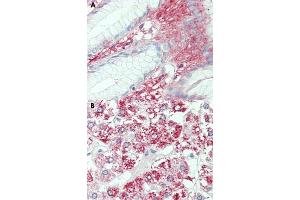 Immunohistochemical staining of human stomach (A) and human adrenal gland (B) with SLC7A2 polyclonal antibody . (SLC7A2 抗体  (Internal Region))