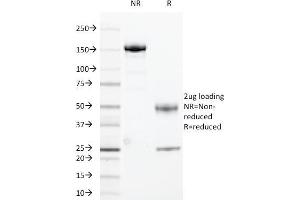 SDS-PAGE Analysis Purified HLA-DRA Mouse Monoclonal Antibody (169-1B5. (HLA-DRA 抗体)