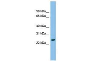 Image no. 1 for anti-Adenylate Kinase 2 (AK2) (AA 143-192) antibody (ABIN6744817) (Adenylate Kinase 2 抗体  (AA 143-192))