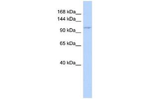 WB Suggested Anti-ZC3H7B Antibody Titration: 0.