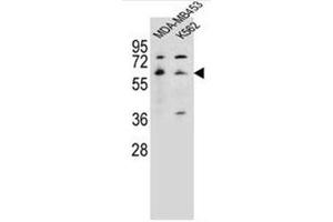 Western blot analysis of HTR3A Antibody (N-term) in MDA-MB453, K562 cell line lysates (35ug/lane). (Serotonin Receptor 3A 抗体  (N-Term))