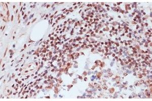 Immunohistochemistry of paraffin-embedded Human appendix using Phospho-CREB1(S133) Polyclonal Antibody at dilution of 1:100 (40x lens). (CREB1 抗体  (pSer133))