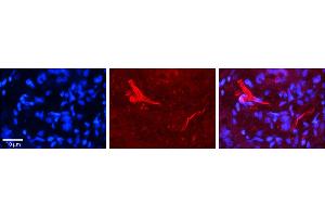 Rabbit Anti-OGT Antibody     Formalin Fixed Paraffin Embedded Tissue: Human Pineal Tissue  Observed Staining: Cytoplasmic in processes of pinealocytes and endothelial cells in blood vessels  Primary Antibody Concentration: 1:100  Other Working Concentrations: 1/600  Secondary Antibody: Donkey anti-Rabbit-Cy3  Secondary Antibody Concentration: 1:200  Magnification: 20X  Exposure Time: 0. (OGT 抗体  (N-Term))