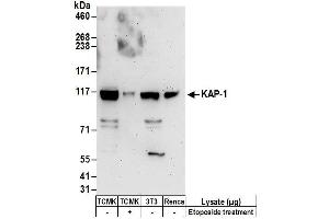 Western Blotting (WB) image for anti-Tripartite Motif Containing 28 (TRIM28) (AA 175-225) antibody (ABIN7450386)