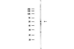 Western blot analysis of lysates from K562 cells(heat-shock 45 min treatment), using Phospho-SHC (Tyr349) Antibody at 1/1000 dilution.