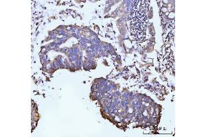 IHC analysis of GLUL using anti-GLUL antibody (ABIN7602403).