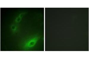 Immunofluorescence analysis of HuvEc cells, using FOXO1A (Ab-329) Antibody.
