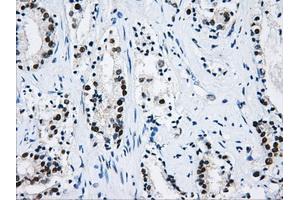 Immunohistochemical staining of paraffin-embedded liver tissue using anti-HNRNPFmouse monoclonal antibody. (HNRNPF 抗体)