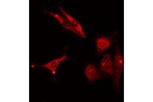 Immunofluorescence (fixed cells) (IF/ICC) image for anti-Proteasome (Prosome, Macropain) 26S Subunit, Non-ATPase, 2 (PSMD2) (C-Term) antibody (ABIN6264489)