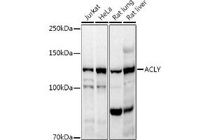 Western blot analysis of extracts of various cell lines, using ACLY antibody (ABIN7265716) at 1:1000 dilution. (ACLY 抗体  (AA 752-1101))