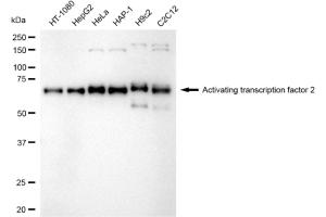 Western blotting analysis using Activating transcription factor 2 antibody (ABIN7797479).