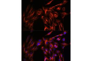 Immunofluorescence analysis of U-2 OS cells using α-Tubulin Rabbit pAb (ABIN3020549, ABIN3020550 and ABIN3020551) at dilution of 1:100 (40x lens). (TUBA4A 抗体  (AA 1-180))