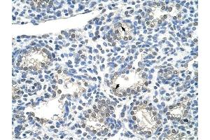 ZNF786 antibody was used for immunohistochemistry at a concentration of 4-8 ug/ml to stain Alveolar cells (arrows) in Human Lung. (ZNF786 抗体  (N-Term))
