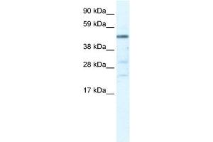 Western Blot showing HSFY1 antibody used at a concentration of 1-2 ug/ml to detect its target protein. (HSFY1 抗体  (N-Term))