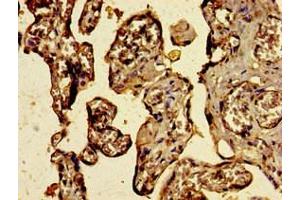 Immunohistochemistry of paraffin-embedded human placenta tissue using ABIN7174832 at dilution of 1:100 (C3ORF14 抗体  (AA 9-128))