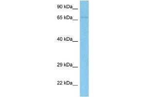 Host:  Rabbit  Target Name:  PUS7  Sample Tissue:  Human 786-0 Whole Cell  Antibody Dilution:  1ug/ml (PUS7 抗体  (N-Term))