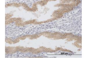Immunostaining (ISt) image for anti-Epithelial Cell Adhesion Molecule (EPCAM) (AA 1-314) antibody (ABIN517593)