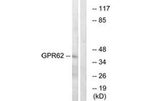 Western blot analysis of extracts from COLO cells, using GPR62 Antibody. (GPR62 抗体  (AA 181-230))