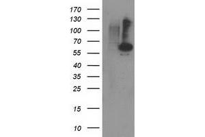 Western Blotting (WB) image for anti-Protein Phosphatase, Mg2+/Mn2+ Dependent, 1B (PPM1B) antibody (ABIN1500373) (PPM1B 抗体)