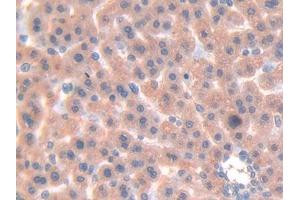 Used in DAB staining on fromalin fixed paraffin- embedded liver tissue (LGALS7 抗体  (AA 1-128))