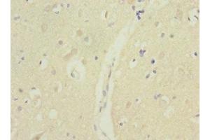 Immunohistochemistry of paraffin-embedded human brain tissue using ABIN7172732 at dilution of 1:100 (MTERFD1 抗体  (AA 69-300))