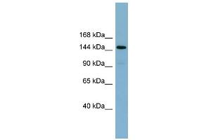 WB Suggested Anti-KIAA1199 Antibody Titration:  0. (CEMIP 抗体  (Middle Region))