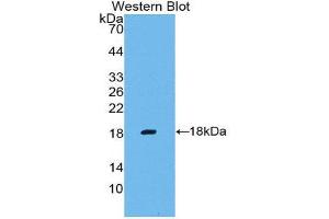 Western Blotting (WB) image for anti-Matrix Metallopeptidase 3 (Stromelysin 1, Progelatinase) (MMP3) (AA 247-370) antibody (ABIN1859855) (MMP3 抗体  (AA 247-370))