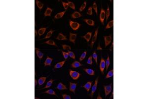 Immunofluorescence (IF) image for anti-Catenin (Cadherin-Associated Protein), alpha 3 (CTNNA3) (AA 1-240) antibody (ABIN7266136)