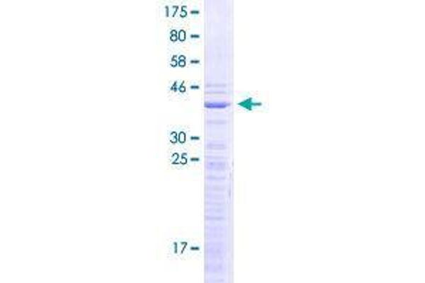 SNRPD1 Protein (AA 1-119) (GST tag)