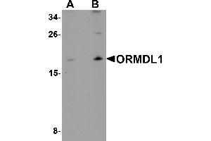 Western blot analysis of ORMDL1 in SK-N-SH Cell lysate with ORMDL1 antibody at (A) 1 µg/mL and (B) 2 µg/mL. (ORMDL1 抗体)