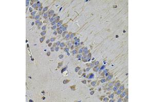Immunohistochemistry of paraffin-embedded rat brain using NAA50 Antibody (ABIN5975518) at dilution of 1/100 (40x lens). (NAA50 抗体)
