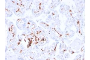 Formalin-fixed, paraffin-embedded human placenta stained with Factor 13A Recombinant Rabbit Monoclonal Antibody (F13A1/3772R). (Recombinant F13A1 抗体  (AA 46-181))