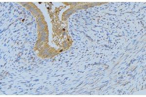 ABIN6268688 at 1/100 staining Human uterus tissue by IHC-P. (IL-4 抗体  (Internal Region))
