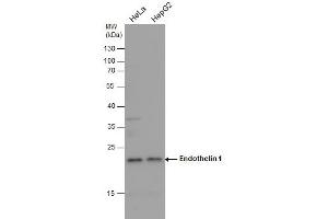 WB Image Endothelin 1 antibody detects Endothelin 1 protein by western blot analysis. (Endothelin 1 抗体  (C-Term))