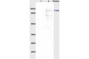 Lane 1: human colon carcinoma lysates Lane 2: rat brain lysates probed with Anti PARP (N-Terminus) Polyclonal Antibody, Unconjugated (ABIN677903) at 1:200 in 4 °C. (PARP1 抗体  (AA 201-300))