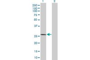 Western Blot analysis of HLA-DRB1 expression in transfected 293T cell line by HLA-DRB1 MaxPab polyclonal antibody.