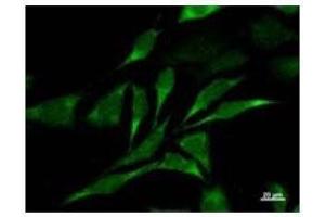 Immunostaining analysis in HeLa cells. (CARD8 抗体)
