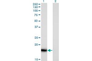Western Blotting (WB) image for anti-HRAS-Like Suppressor 3 (PLA2G16) (AA 1-163) antibody (ABIN961519) (PLA2G16 抗体  (AA 1-163))